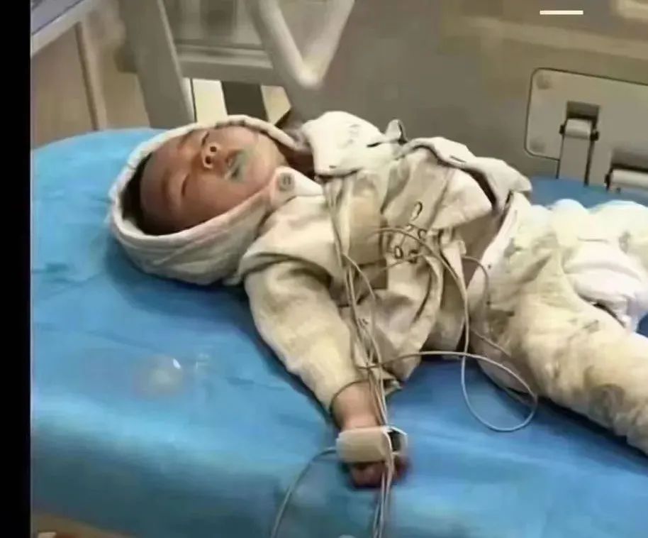 核酸检测证明再次害人：网传江苏睢宁一岁半孩子卡到喉咙，因无核酸证明被拒诊后身亡